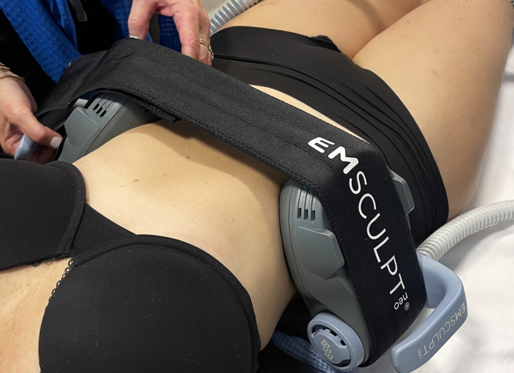 Emsculpt NEO treatment on the abdomen