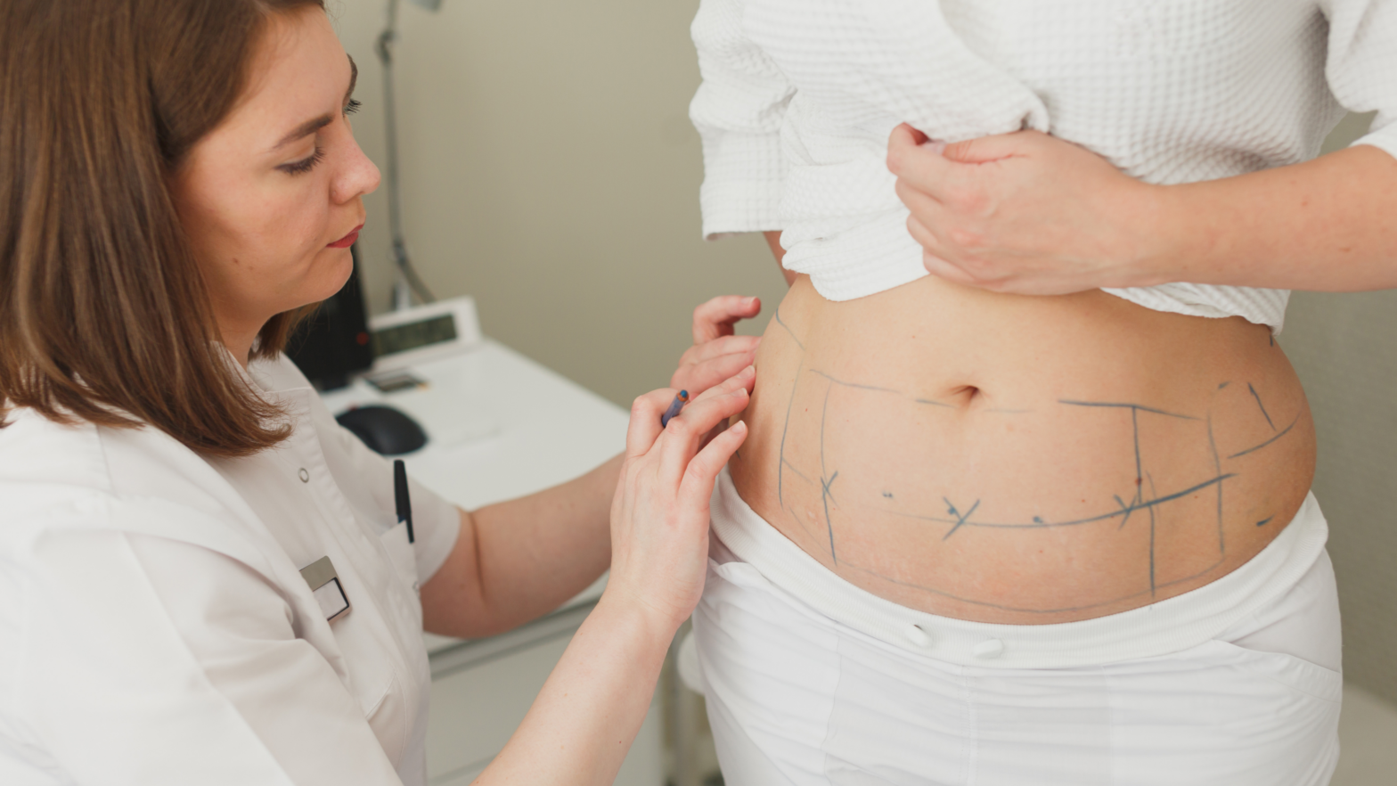 woman receiving liposuction