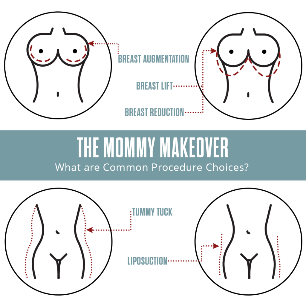 Mommy Makeover Procedures