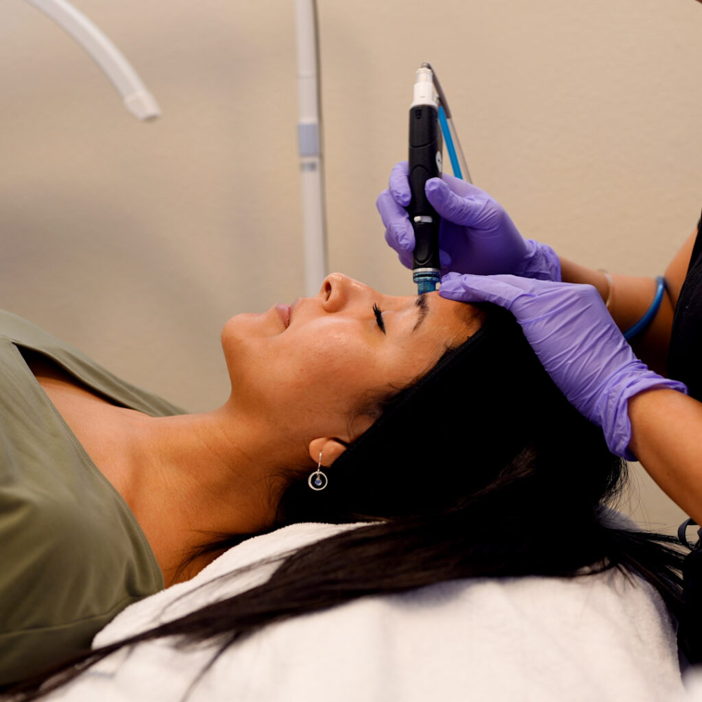 hydrafacial treatment