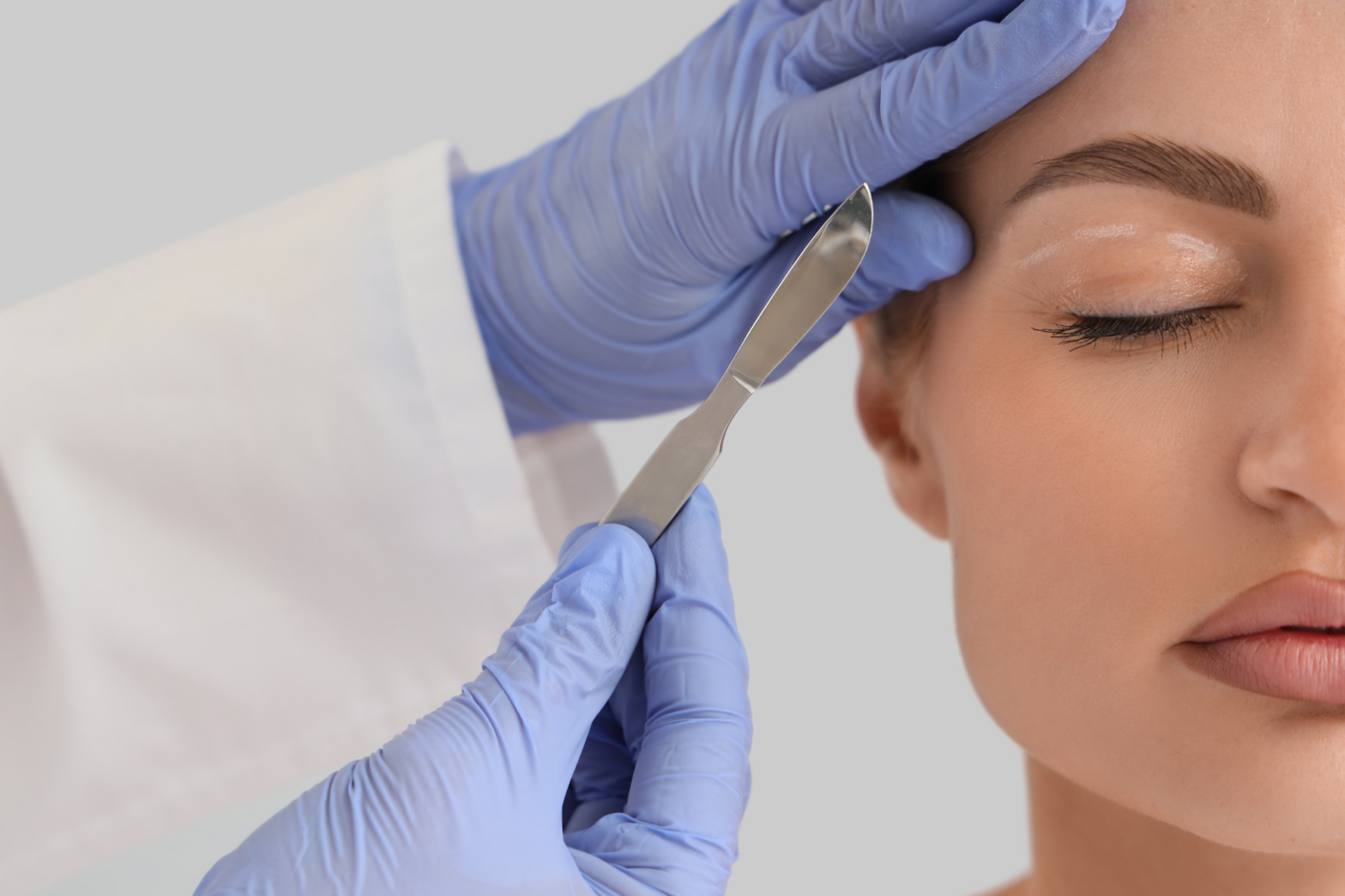 Blepharoplasty of woman