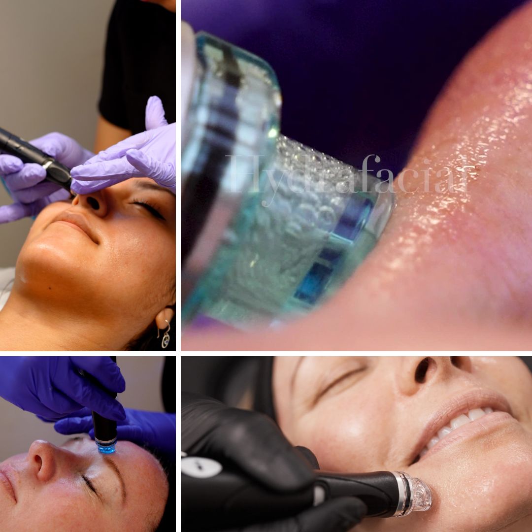 hydrafacial-event